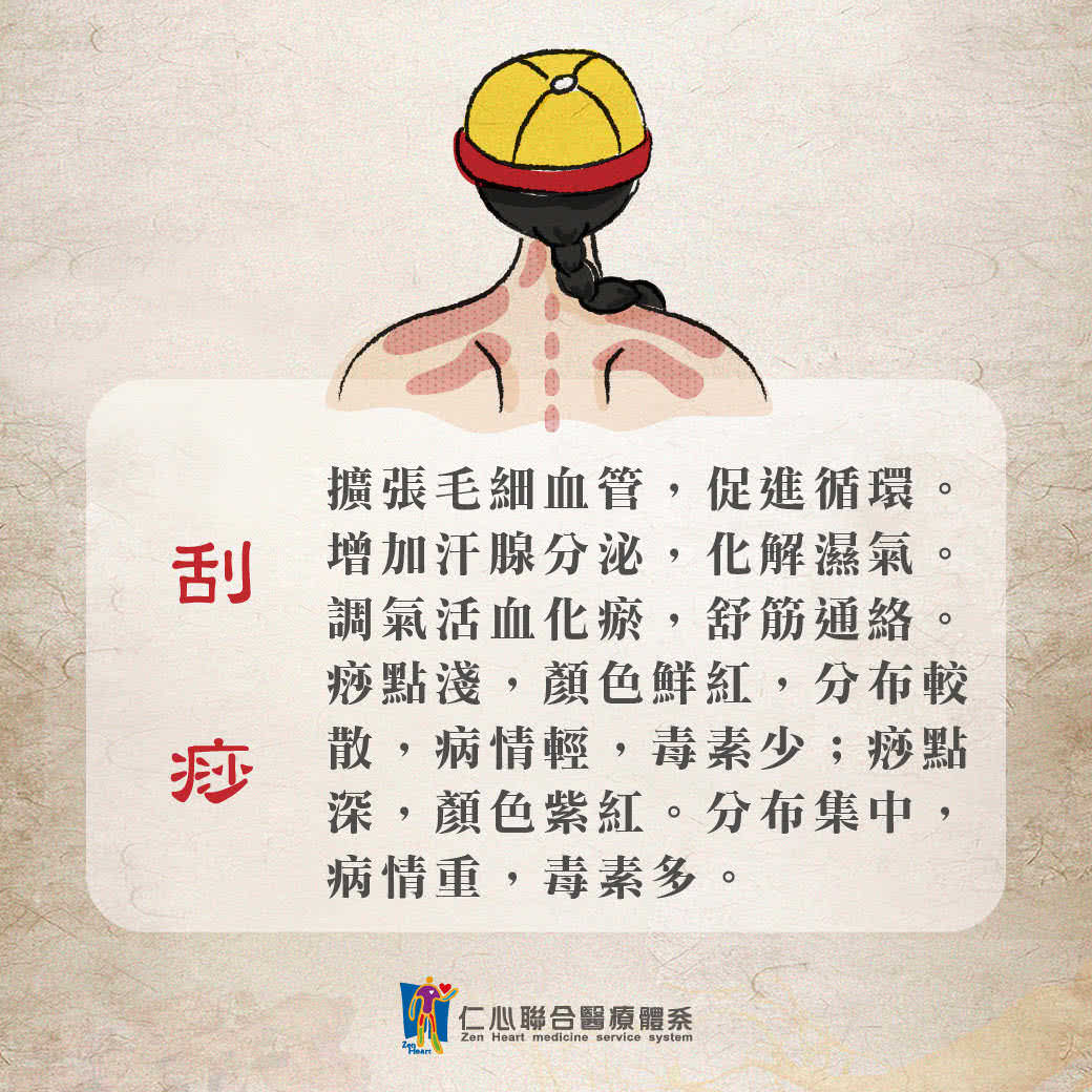 刮痧